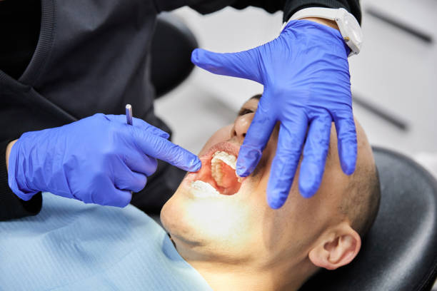 Best Emergency Dentist for Knocked-Out Tooth in Powell, AL
